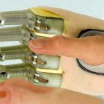ProDigits the Worlds First Bionic Finger