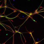 Human Neurons Successfully Implanted Into Mice