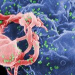 HIV killed by Engineered Stem Cells in a Study