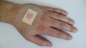 Colour Changing Plasters Indicate Wound Infection