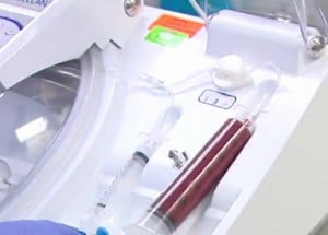 Stem Cell Spray