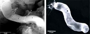 Alien Bacteria
