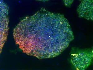 Stem Cell mutation
