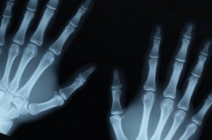 3D Printer Bone