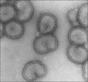 Viruses