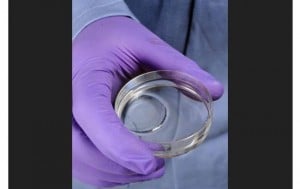 Hydrogel