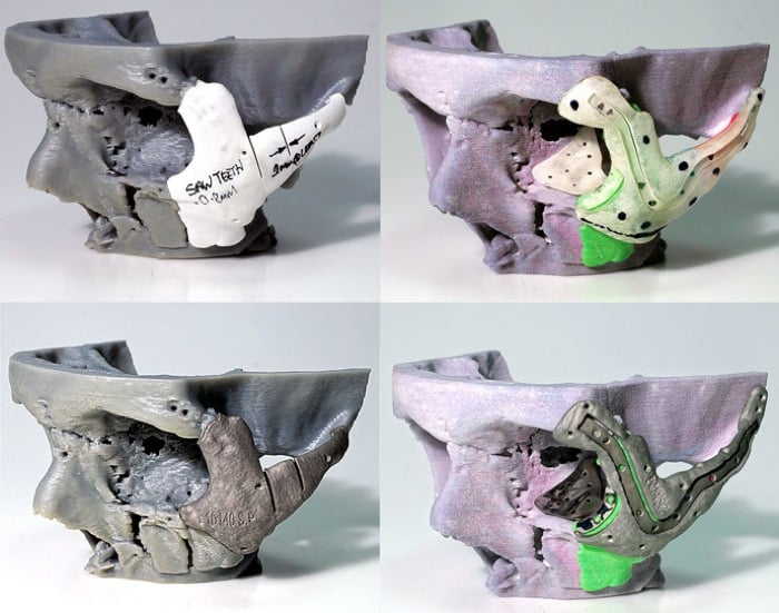 3D Printing