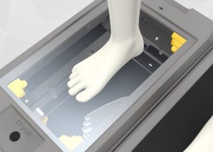 CryoScan3D Foot Scanner