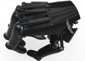 myoelectric prosthesis
