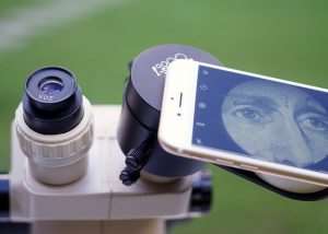Digital Microscope Using Your Smartphone