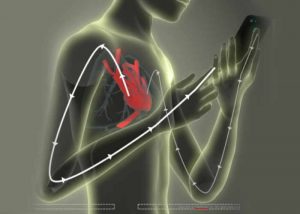 MediaTek Sensio Smartphone Biosensor
