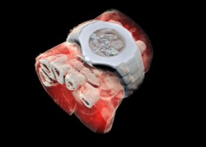 First 3D Colour X-Rays Captured