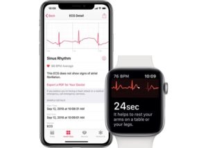 Apple Watch Series 4