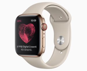 Apple Watch ECG