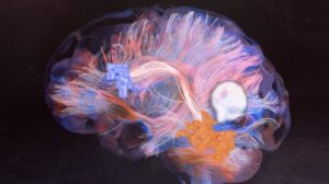Connectomics Mapping the Brain using artificial intelligence