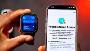 watchOS 11 Beta 5