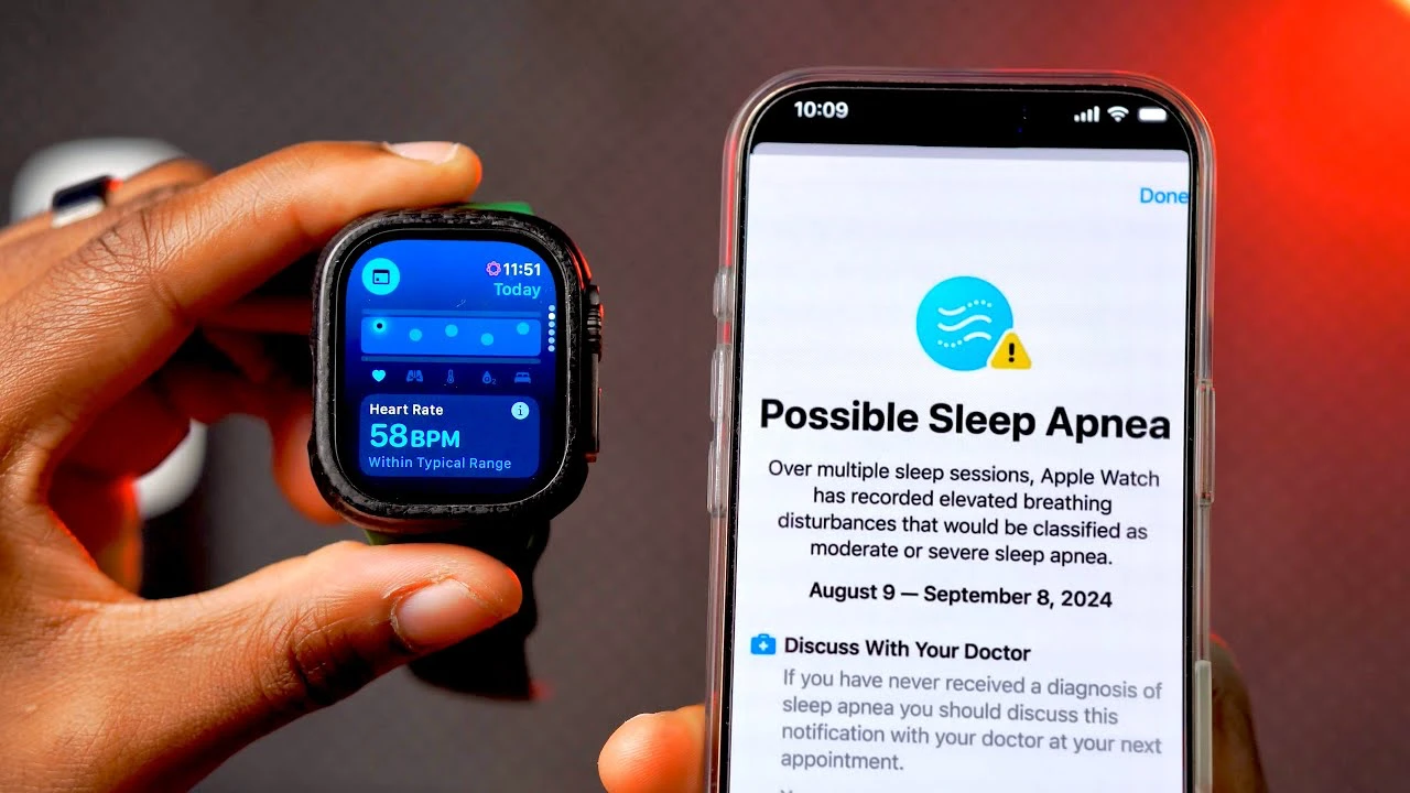 watchOS 11 Beta 5