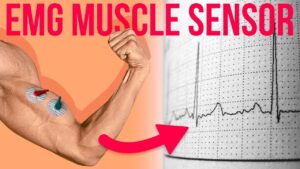 An EMG sensor setup showing electrodes and a microcontroller for muscle signal detection